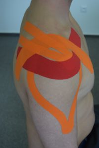 Kinesiotaping