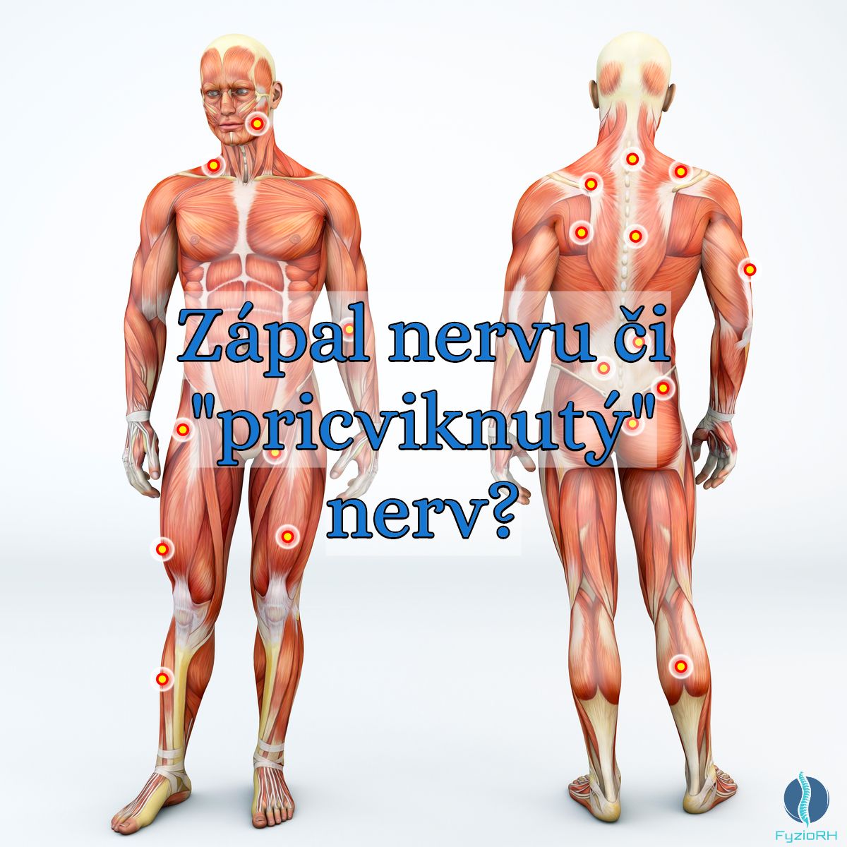 Zápal nervu či pricviknutý nerv